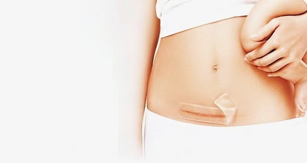 Dlaczego grube arkusze na blizny z żelem silikonowym są tak popularne?